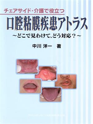 チェアサイド・介護で役立つ口腔粘膜疾患アトラス どこで見わけて、どう対応？