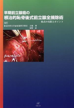 早期前立腺癌の根治的恥骨後式前立腺全摘除術 術式の実際とポイ