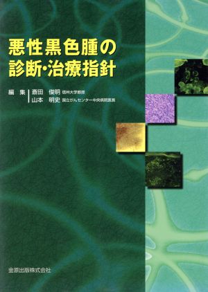 悪性黒色腫の診断・治療指針