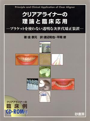 クリアアライナーの理論と臨床応用 ブラケットを使わない透明な次世代矯正装置