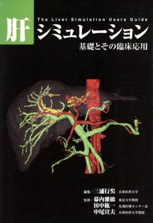 肝シミュレーション 基礎とその臨床応用