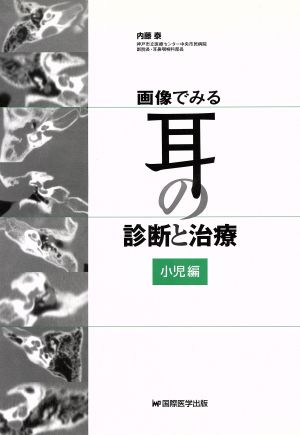 画像でみる耳の診断と治療 小児編