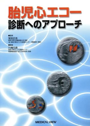 胎児心エコー診断へのアプローチ