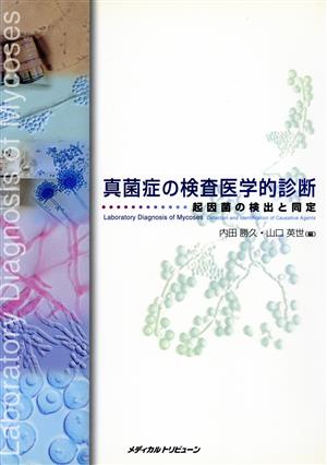 真菌症の検査医学的診断 起因菌の検出と同定