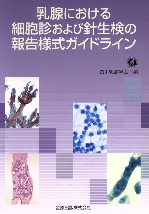 乳腺における細胞診および針生検の報告様式ガイドライン