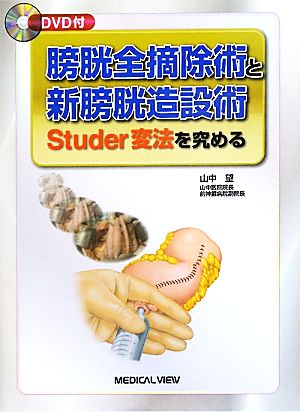 膀胱全摘除術と新膀胱造設術 Studer変法を究める