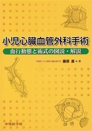 小児心臓血管外科手術 血行動態と術式の図