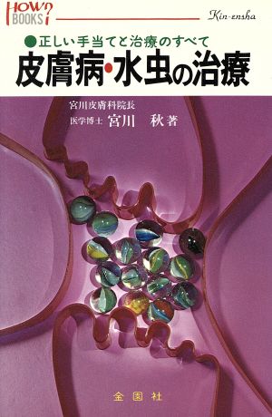 水虫の治療 水虫と皮膚病はこうして治す