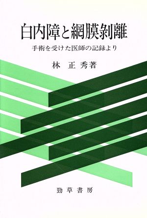 白内障と網膜剥離 手術を受けた医師の記録より