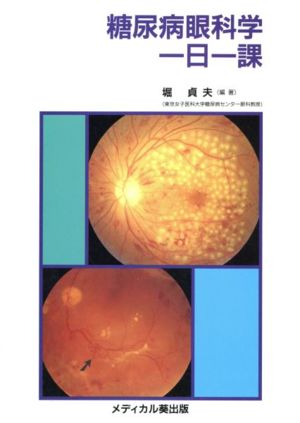 糖尿病眼科学一日一課