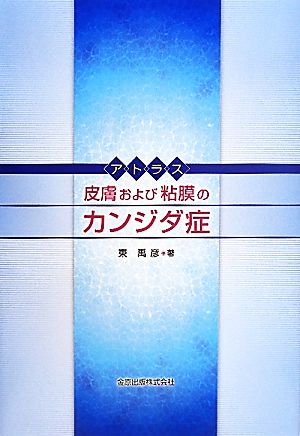 アトラス 皮膚および粘膜のカンジダ症