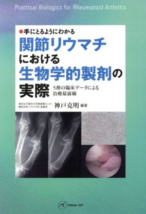 関節リウマチにおける生物学的製剤の実際