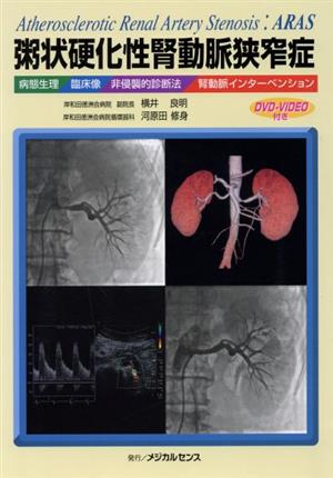 粥状硬化性腎動脈狭窄症 病態生理/臨床像/非侵襲的診断法/腎動脈インターベンション