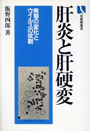 肝炎と肝硬変 実態の変化とウイルスの役割