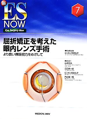 屈折矯正を考えた眼内レンズ手術 より良い裸眼視力をめざして 新ES NOWNo.7