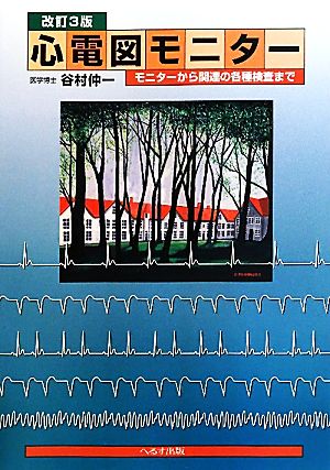 心電図モニター モニターから関連の各種検査まで