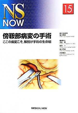 傍鞍部病変の手術(15) ここの病変こそ、解剖が手術の生命線 NS NOWNo.15