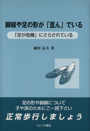 脚線や足の形が「歪ん」でいる 「足が危機」にさらされている