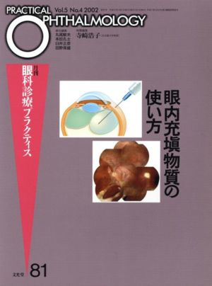 眼内充填物質の使い方