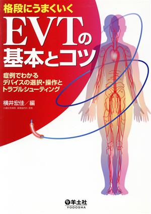 格段にうまくいくEVTの基本とコツ