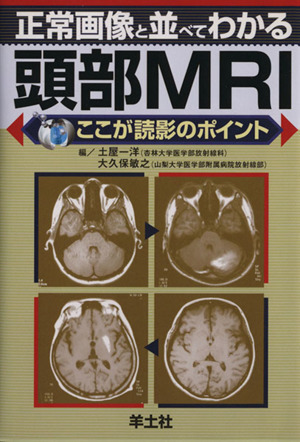 正常画像と並べてわかる頭部MRI ここが読影のポイント