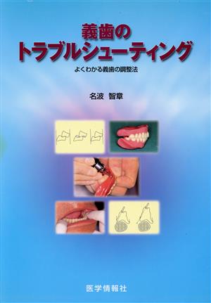 義歯のトラブルシューティング よくわかる義歯の調整法