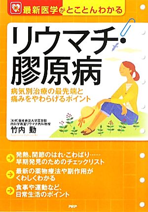 リウマチ・膠原病 病気別治療の最先端と痛みをやわらげるポイント 最新医学がとことんわかる