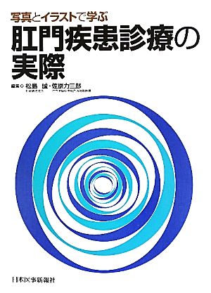 写真とイラストで学ぶ肛門疾患診療の実際