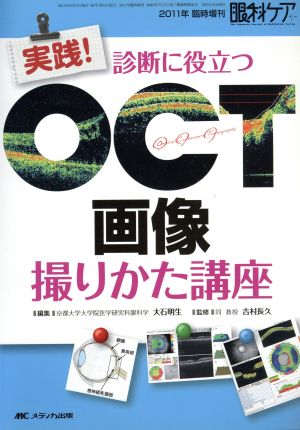 実践！診断に役立つOCT画像撮りかた講座