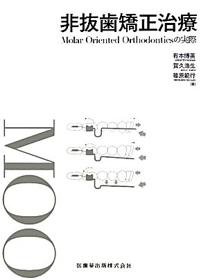 非抜歯矯正治療 Molar Oriented Orthodonticsの実際