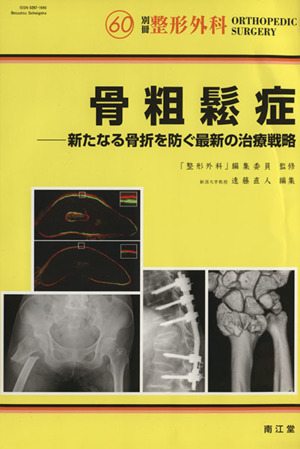 骨粗鬆症-新たなる骨折を防ぐ最新の治療戦略 別冊整形外科60