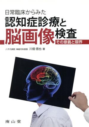 日常臨床から見た認知症診療と脳画像検査