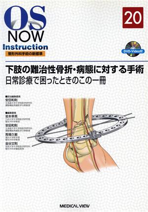 下肢の難知性骨折・病態に対する手術のコツ 日常診療で困ったときのこの一冊