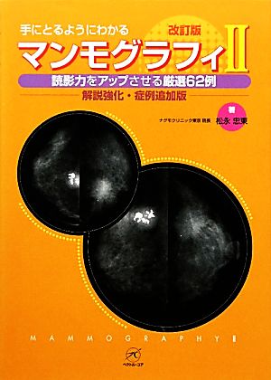 マンモグラフィ(2) 解説強化・症例追加版-読影力をアップさせる厳選62例