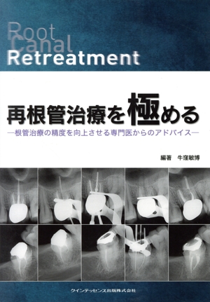 再根管治療を極める 根管治療の精度を向上させる専門医からのアドバイス