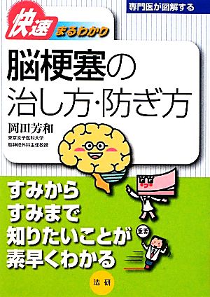 脳梗塞の治し方・防ぎ方 専門医が図解するシリーズ快速まるわかり