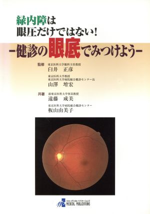 緑内障は眼圧だけではない！ 健診の眼底でみつけよう