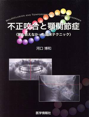 不正咬合と顎関節症 誰も教えてくれなかった臨床テクニック