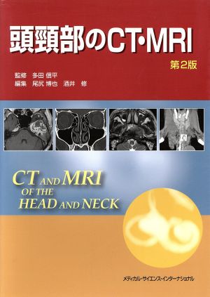頭頸部のCT・MRI 第2版