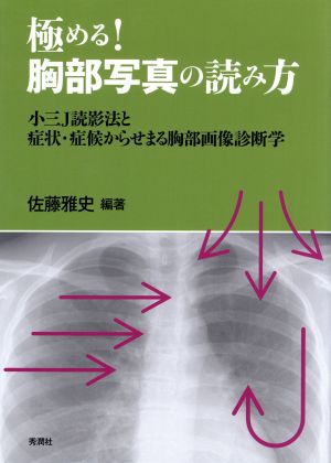 極める！胸部写真の読み方 小三J読影法と症状・症候からせまる胸部画像診断学