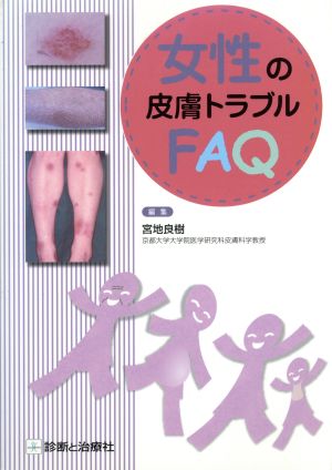女性の皮膚トラブルFAQ