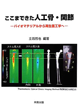 ここまできた人工骨・関節 バイオマテリアルから再生医工学へ