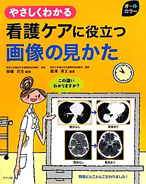 オールカラー やさしくわかる看護ケアに役立つ画像の見かた やさしくわかる