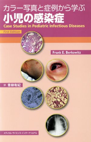 カラー写真と症例から学ぶ小児の感染症