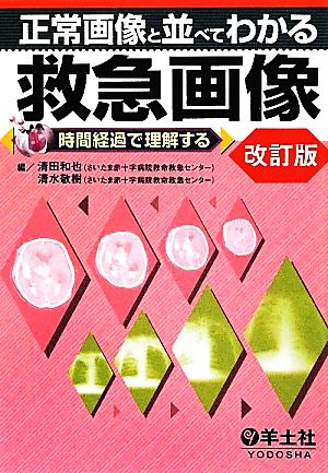 正常画像と並べてわかる救急画像 改訂版 時間経過で理解する