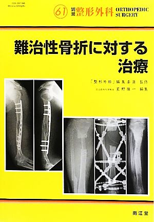 難治性骨折に対する治療 別冊整形外科61