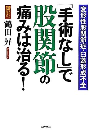 「手術なし」で股関節の痛みは治る！ 変形性股関節症・臼蓋形成不全