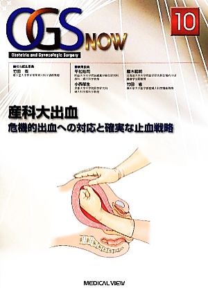 産科大出血(10)危機的出血への対応と確実な止血戦略OGS NOWNo.10