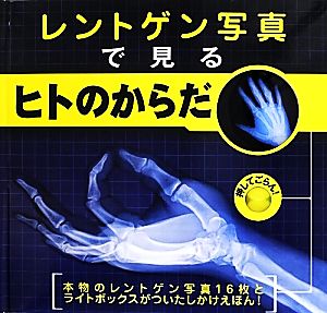 レントゲン写真で見るヒトのからだ 本物のレントゲン写真16枚とライトボックスがついたしかけえほん！ しかけえほん