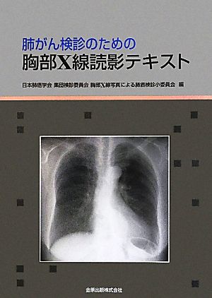 肺がん検診のための胸部X線読影テキスト